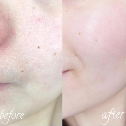 探寻守望先锋雾子皮肤的魅力与独特之处—守望先锋雾子皮肤详细解析